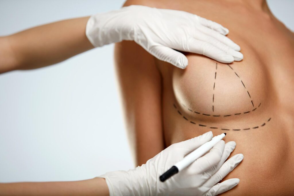 Breast Implant Removal Turkey