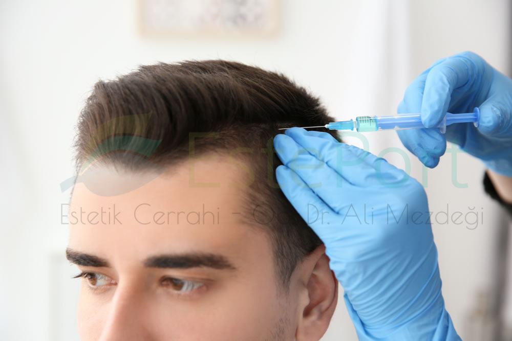 Hair Transplantation Turkey