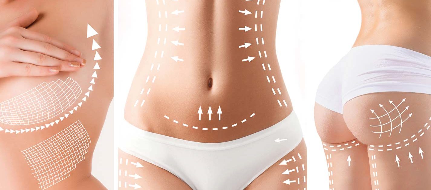 Micro Laser Liposuction in Turkey