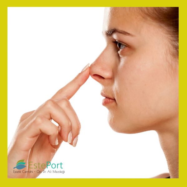 Nasenkorrektur (Rhinoplastik)