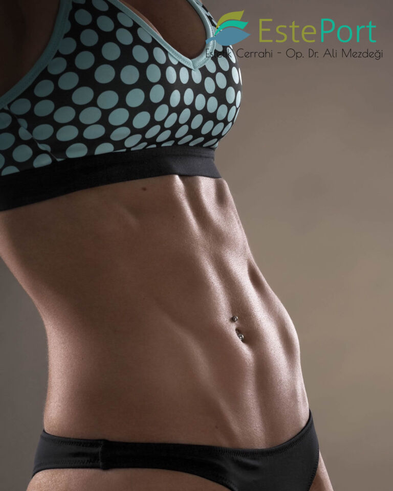 Vollständige (Totale) Bauchdeckenstraffung