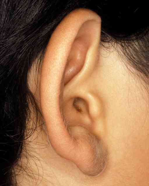 Kepçe kulak ameliyatı sağlığa-zararlı mıdır