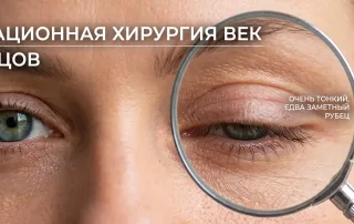 Остаются ли шрамы после блефаропластики