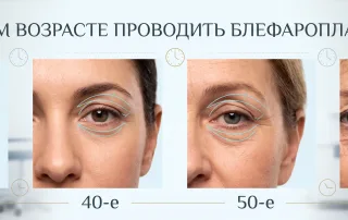 С какого возраста можно делать блефаропластику
